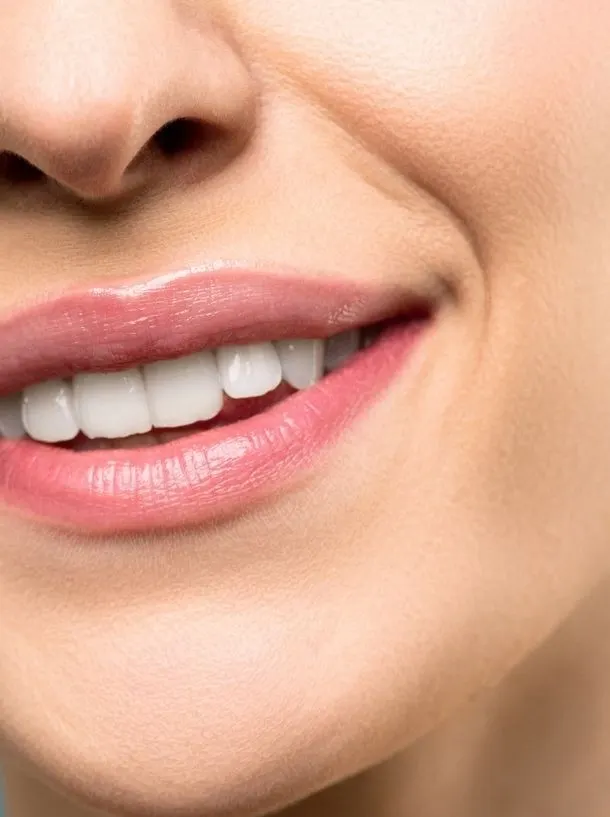 Sorriso com dentes brancos e saudáveis