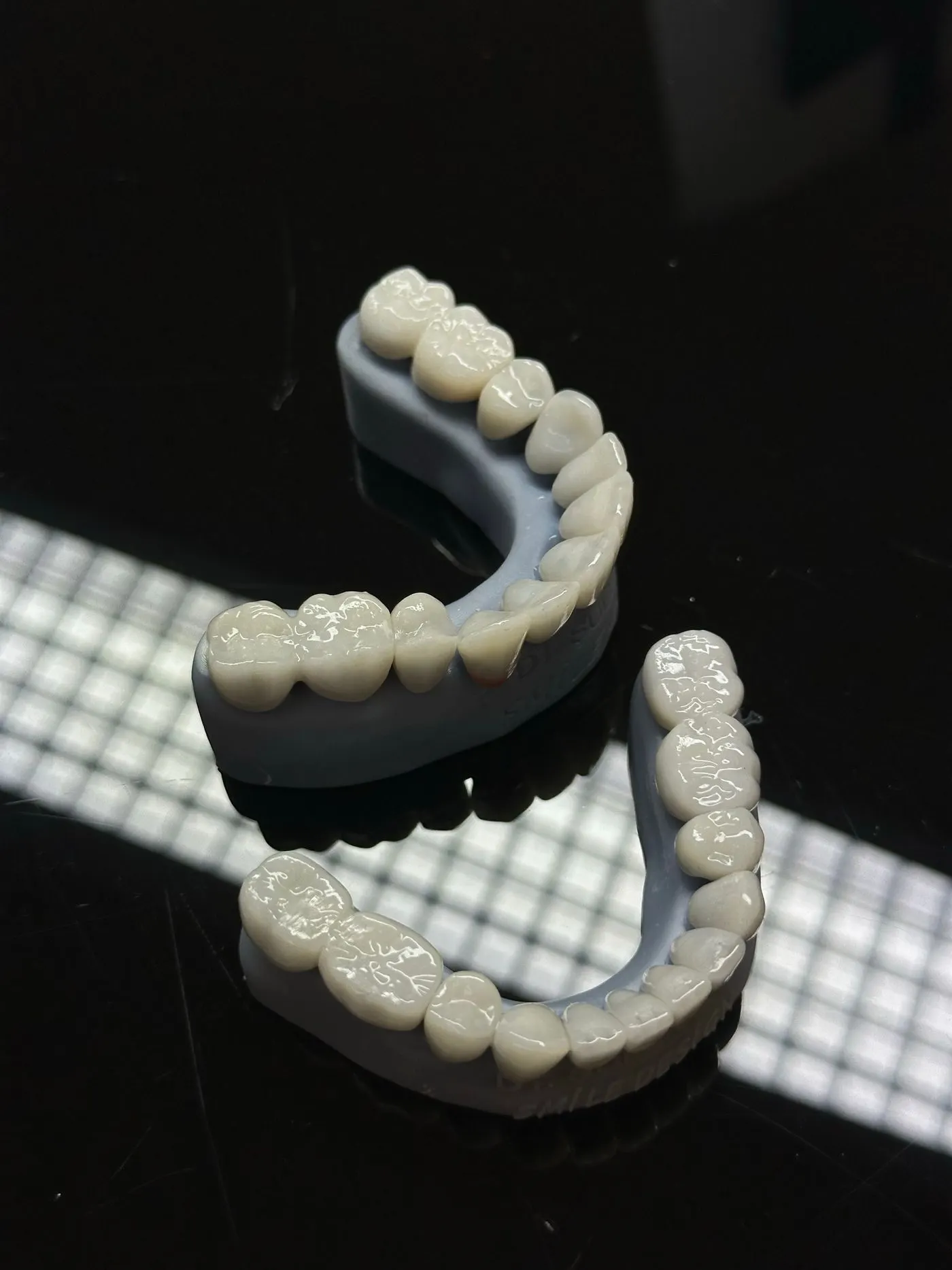 Coroas de porcelana sobre modelo odontológico